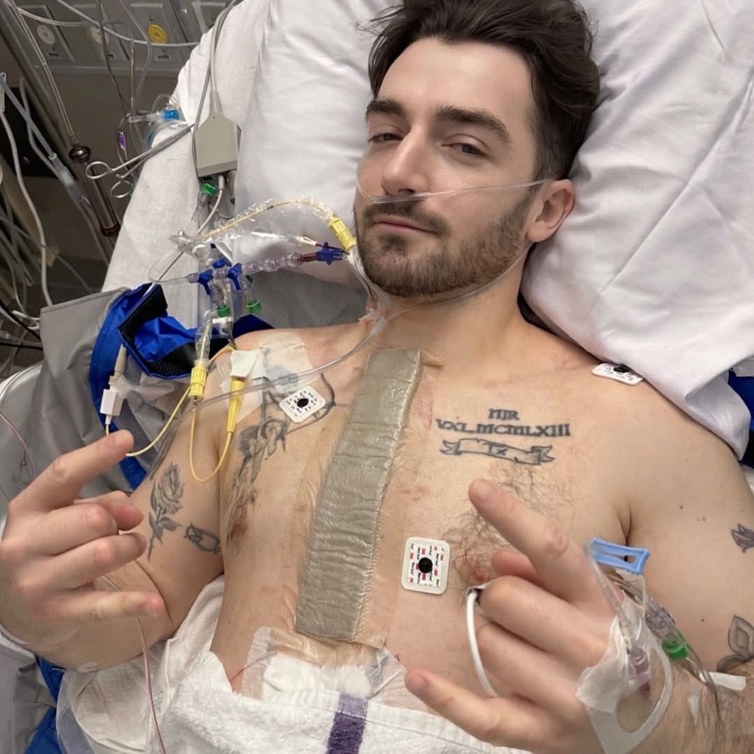 Liam Neeson's Son Daniel Undergoes Surgery for Congenital Heart Defect