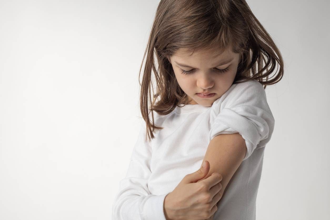 Managing Atopic Dermatitis in Kids