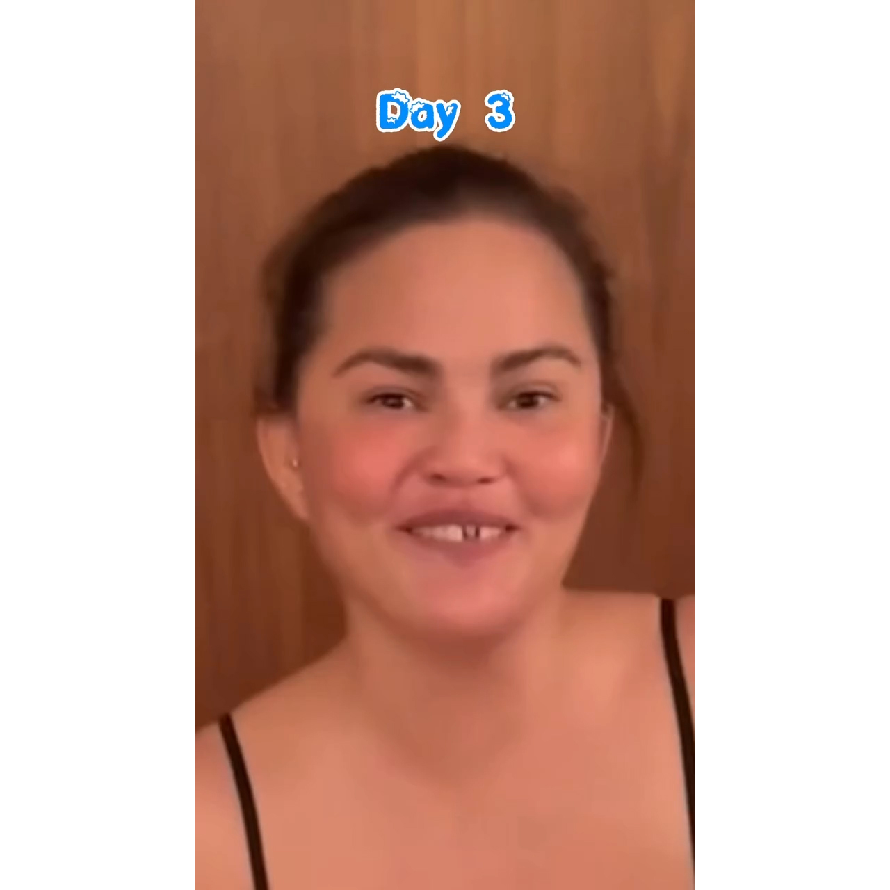 Chrissy Teigen Knocks Out Her Own Front Tooth in Candy Cane Mishap