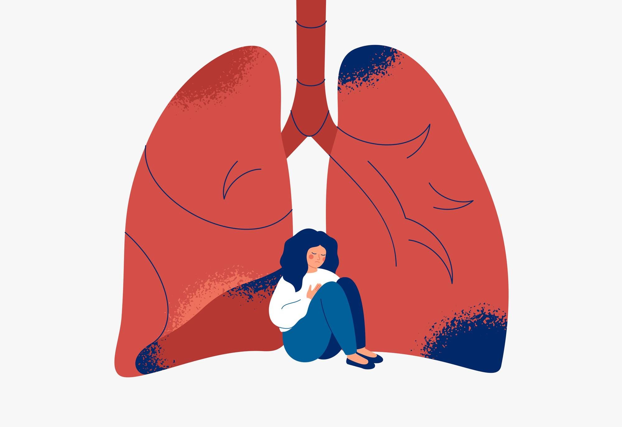 Women and Lung Cancer: A Deadly Combination