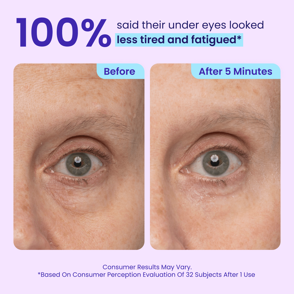 Aging Around the Eyes? This Viral Skincare Find Tightens Sagging Skin