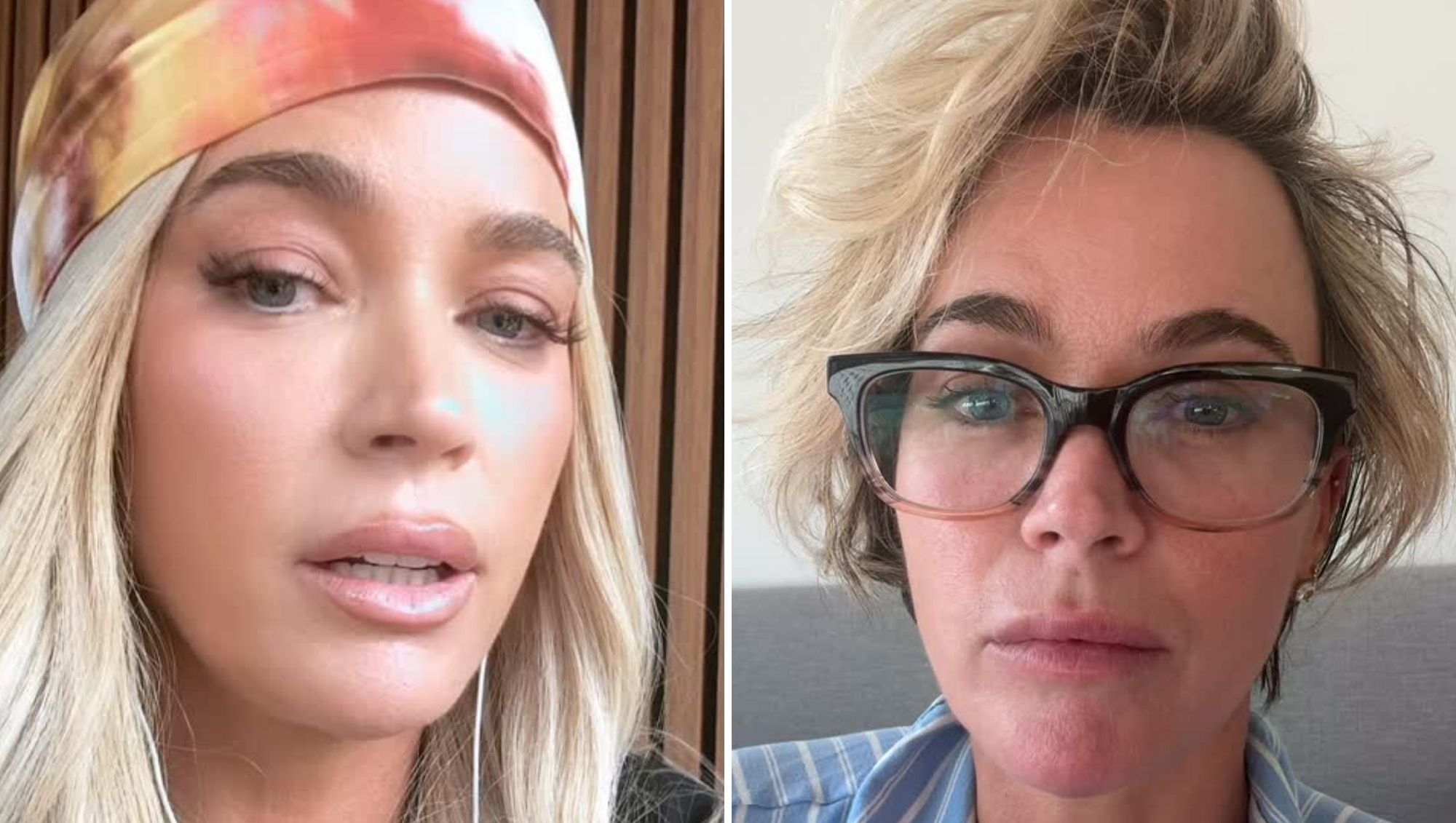 Teddi Mellencamp Takes Off Her Wig, Shows Real Hair Amid Cancer Battle