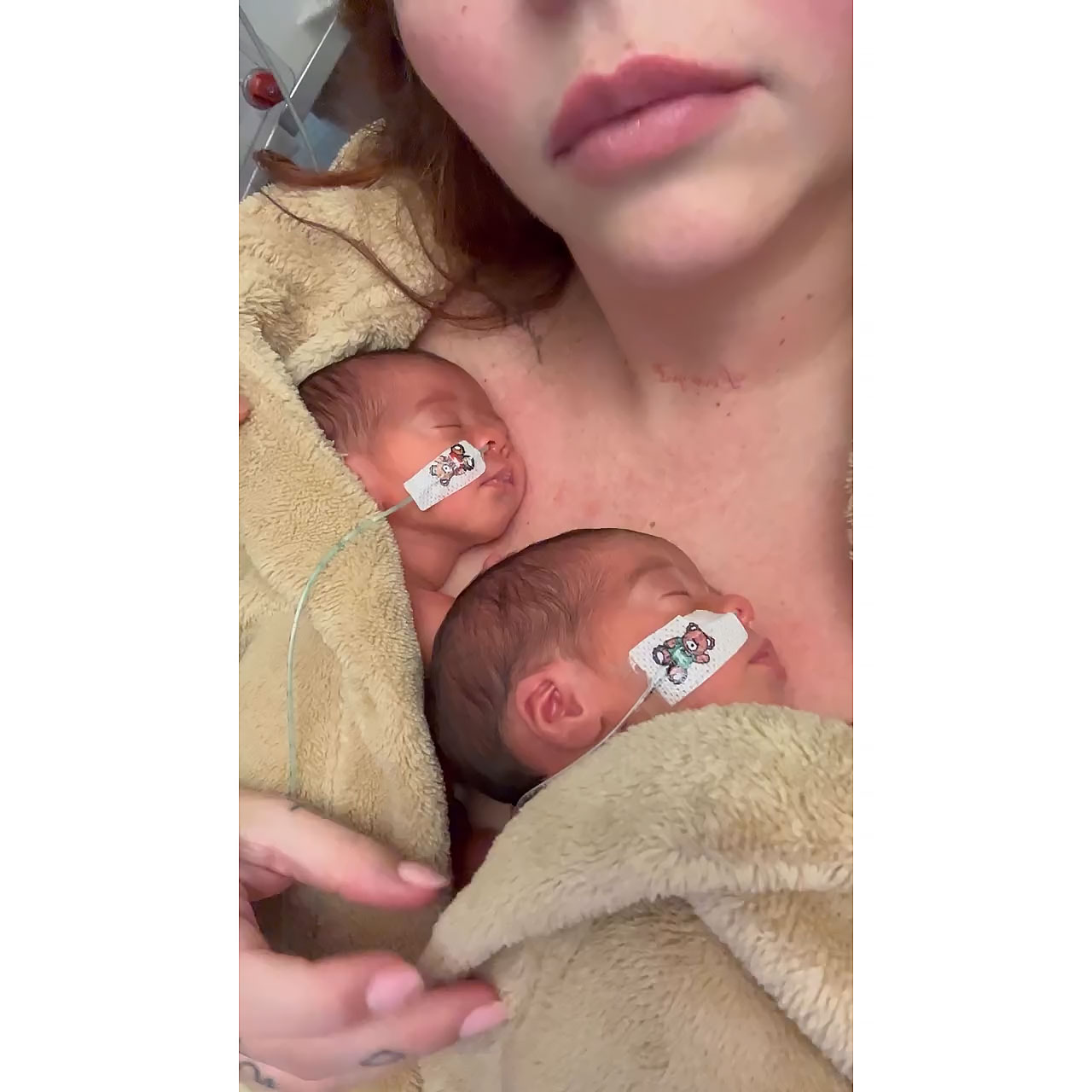 Jesy Nelson Shares Update on 14-Month-Old Twin Girls After Operations