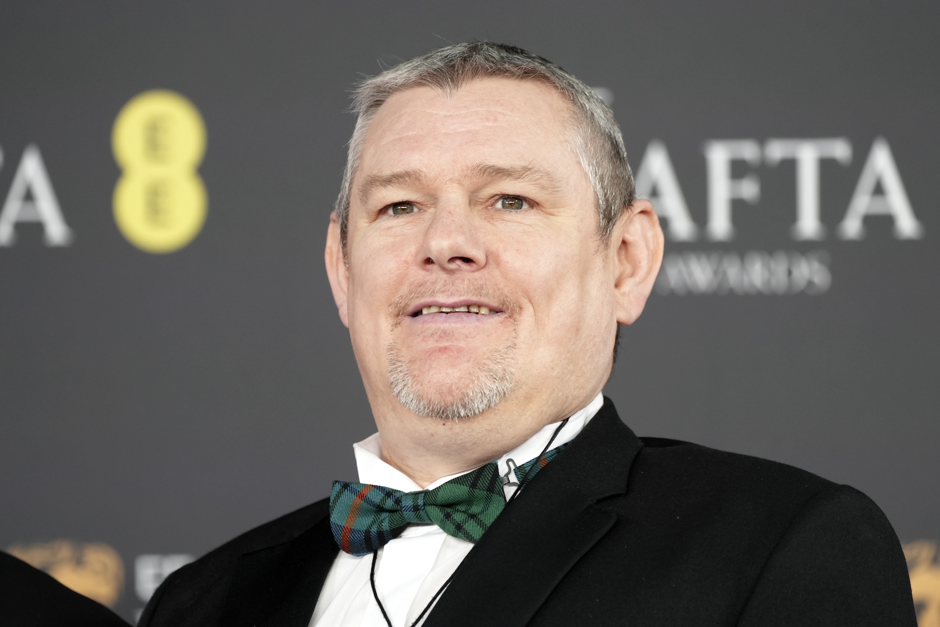 Alan Cumming Addresses Attendee’s Tourette's Outbursts at 2026 BAFTA Awards