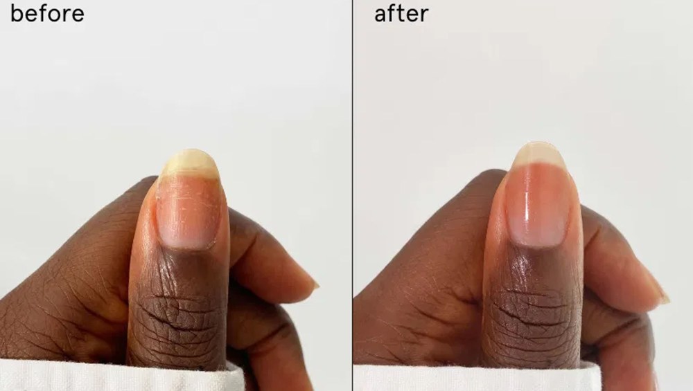 Transform Brittle Nails in Two Weeks With This Treatment