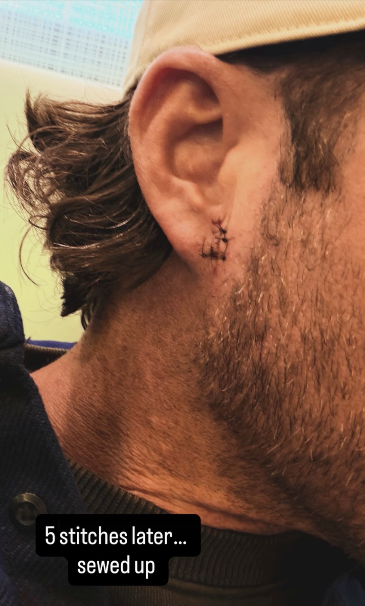 Riley Green Gets 5 Stitches After Fan Throws Phone at His Head: 'Sewed Up'