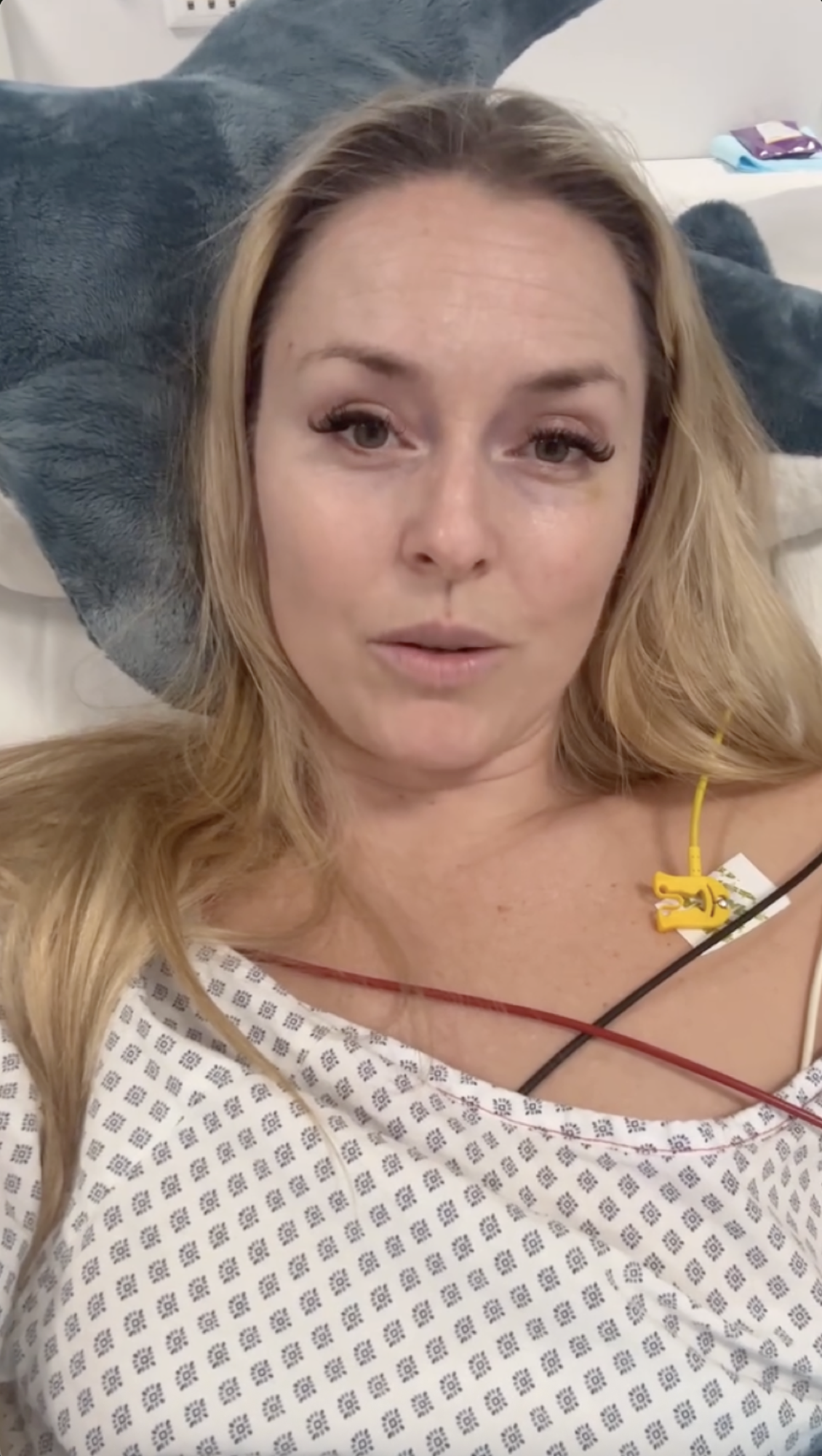 Lindsey Vonn Reveals How Many More Surgeries She Needs After Olympic Crash