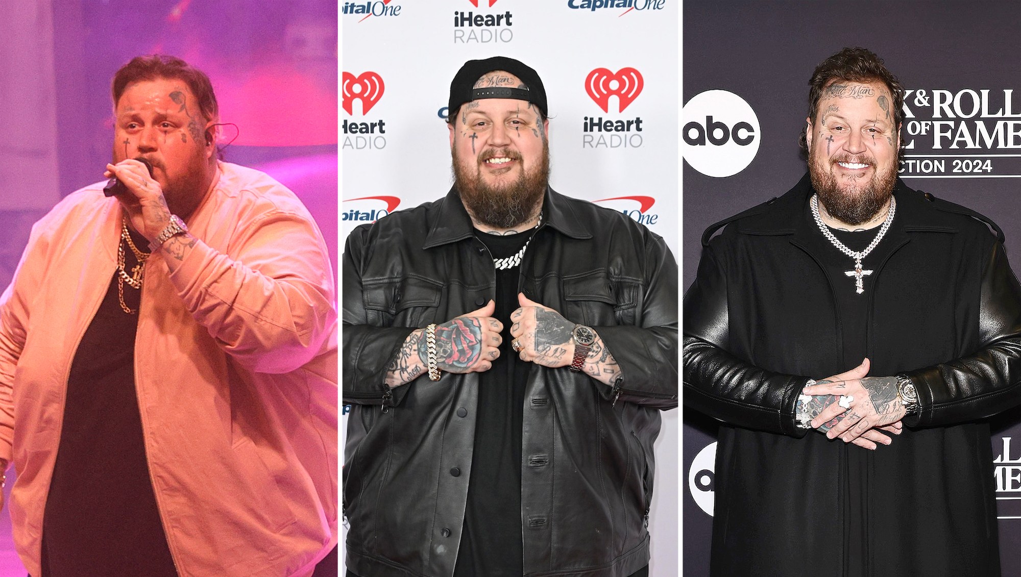 Jelly Roll's Weight Loss Transformation Through the Years