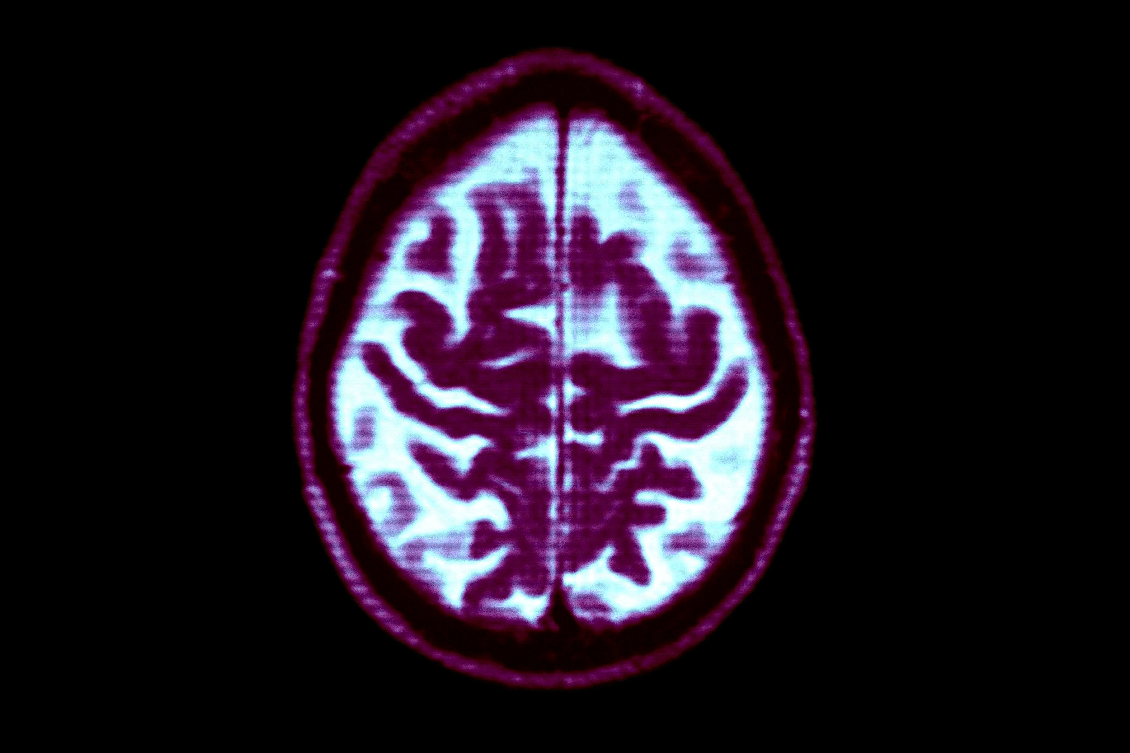 We’re not as helpless against dementia as we think