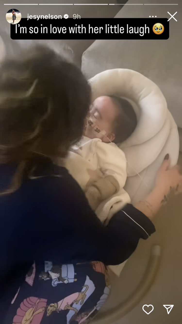 Little Mix's Jesy Nelson Shares Pic of 8-Month-Old Daughter's Feeding Tube