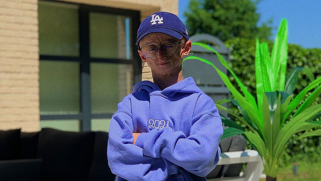 Influencer Michiel Vandeweert With Rare Genetic Disorder Dies at Age 28