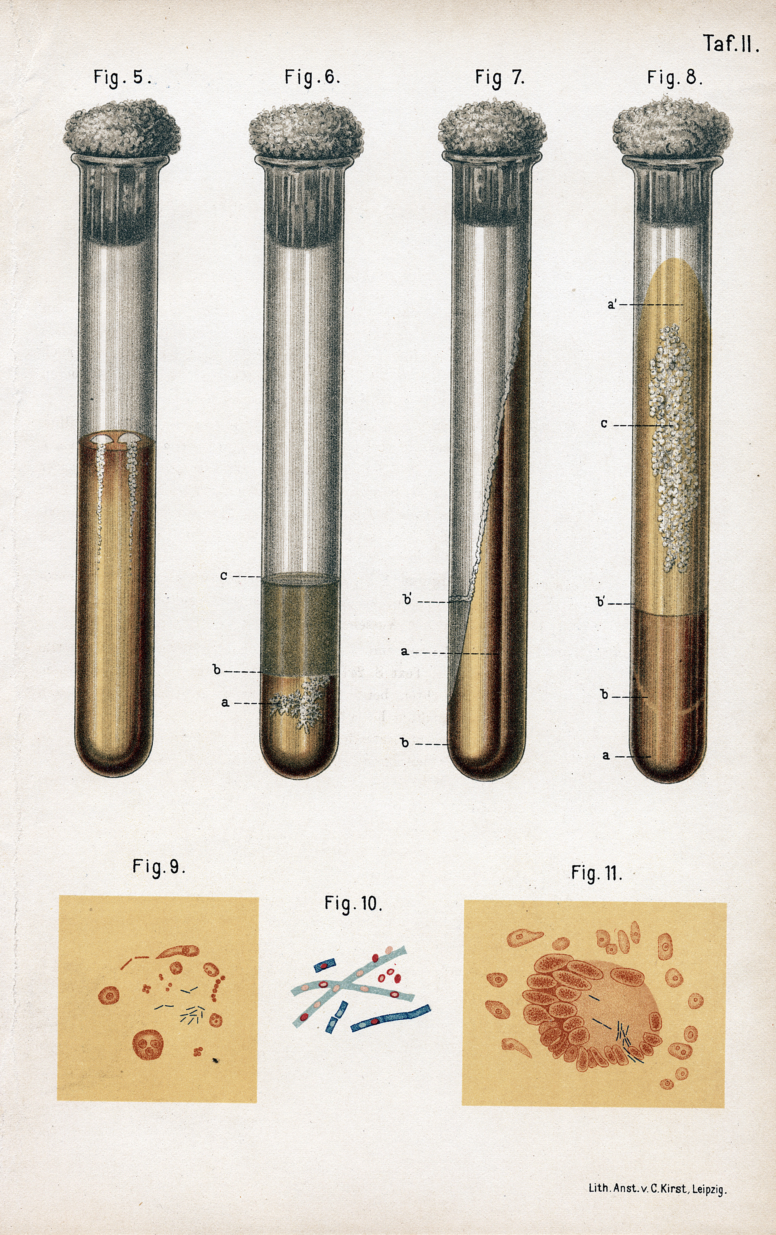 The world’s deadliest infectious disease is on the rise in the US