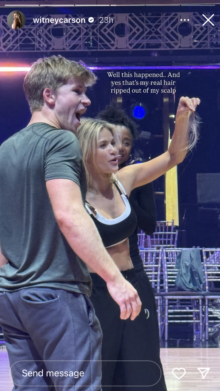 Witney Carson Reveals Hair Clump ‘Ripped Out’ During ‘DWTS’ Finale Rehearsal