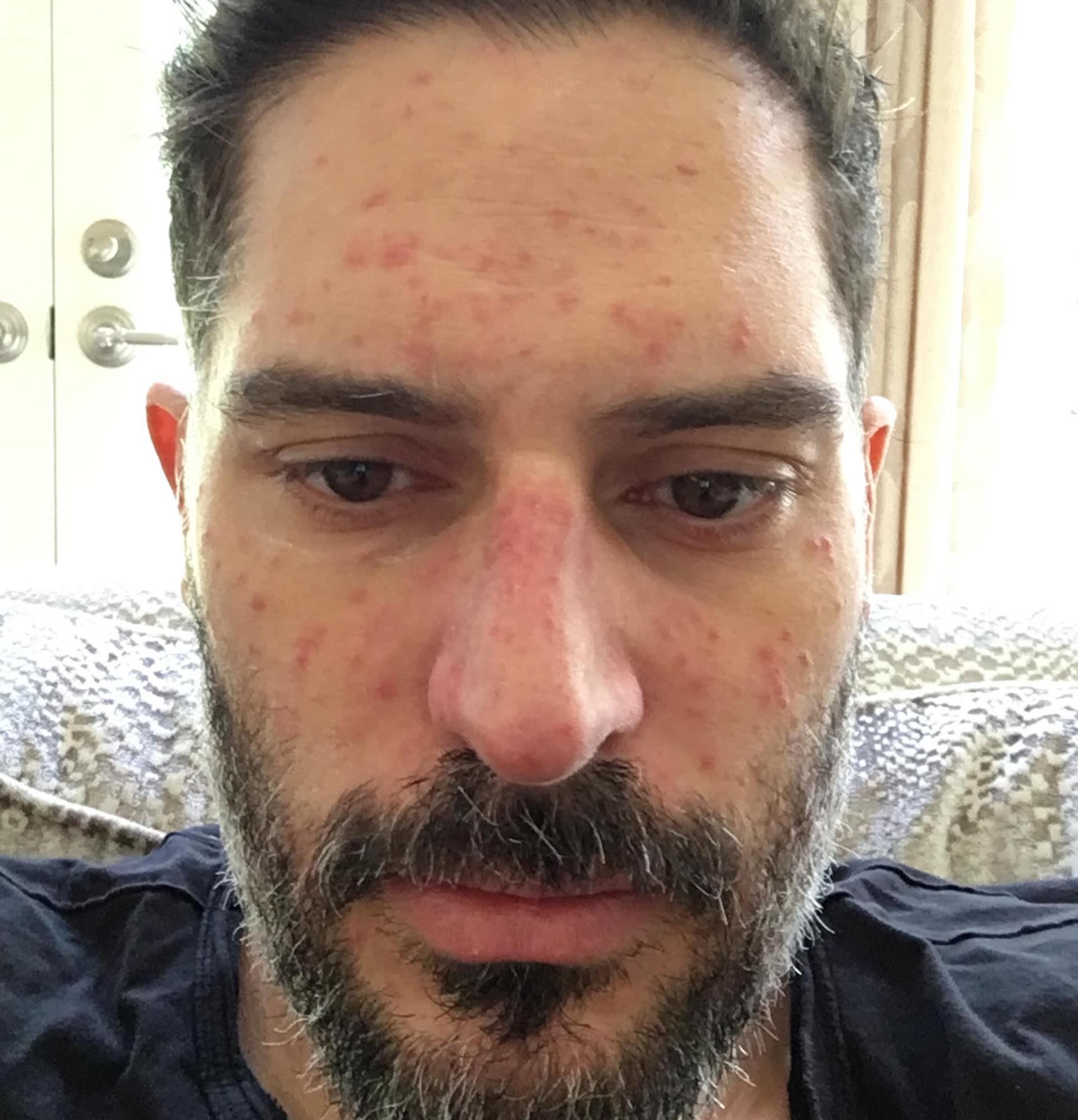 Joe Manganiello Shares Hospital Photos From 7-Year Health Battle