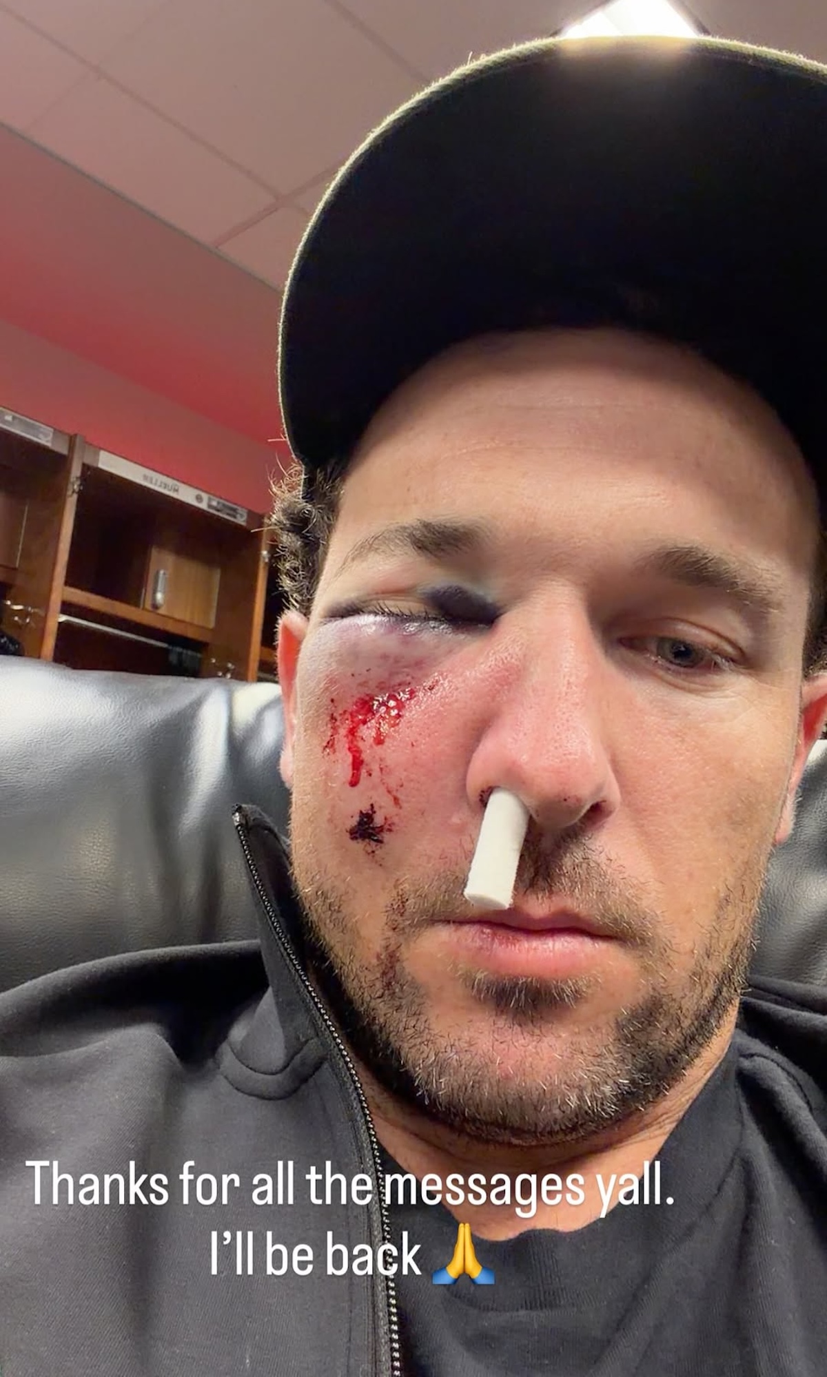 Cubs’ Alex Bregman Shares Gnarly Photo After Getting Hit in Face by Foul Ball