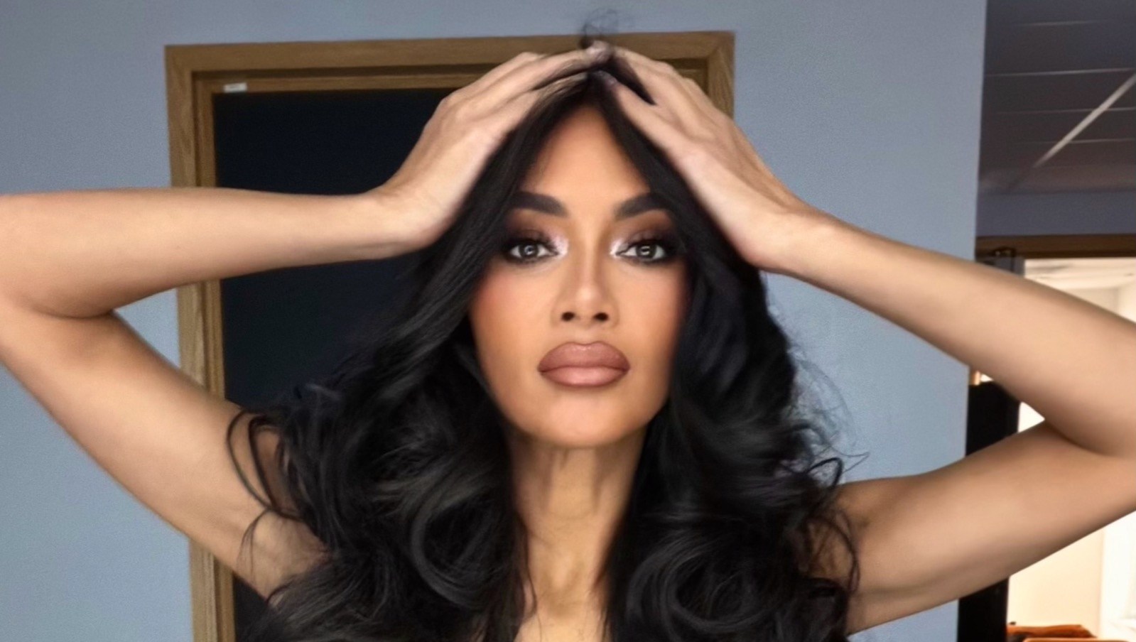 Nicole Scherzinger Shares Update After Suffering Gnarly Boiling Water Burn