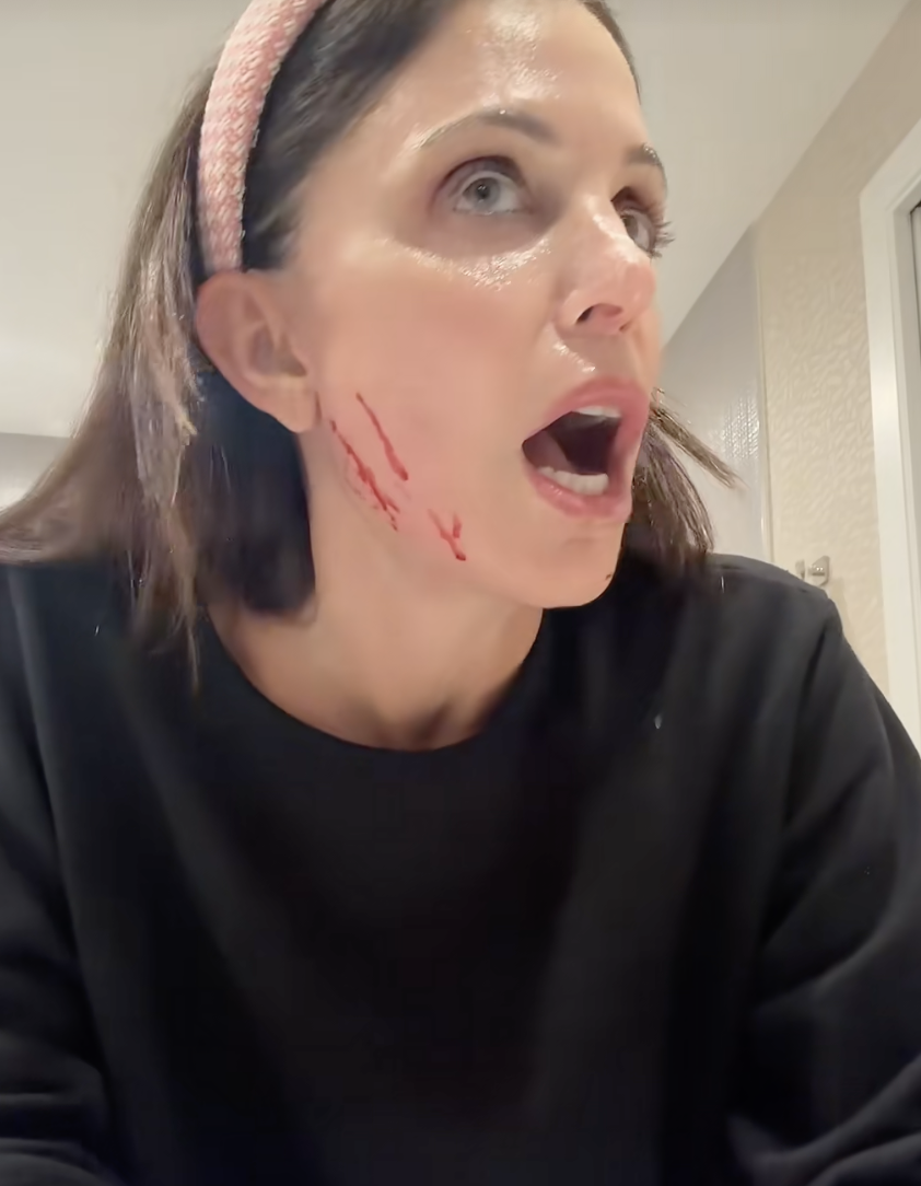 Bethenny Frankel Cuts Her Face Open With New Skincare Product: 'So Scary'