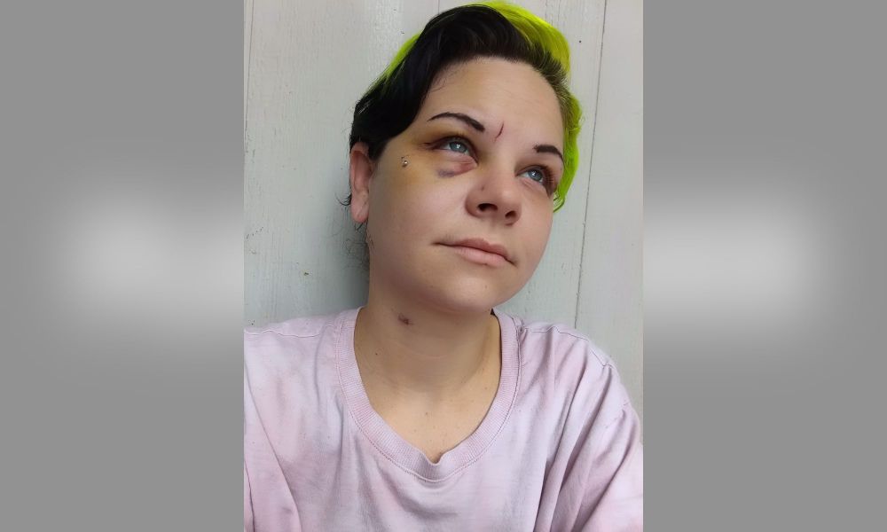 Arizona Man Allegedly Stabbed Fiancee With Scissors Weeks Before Their Wedding
