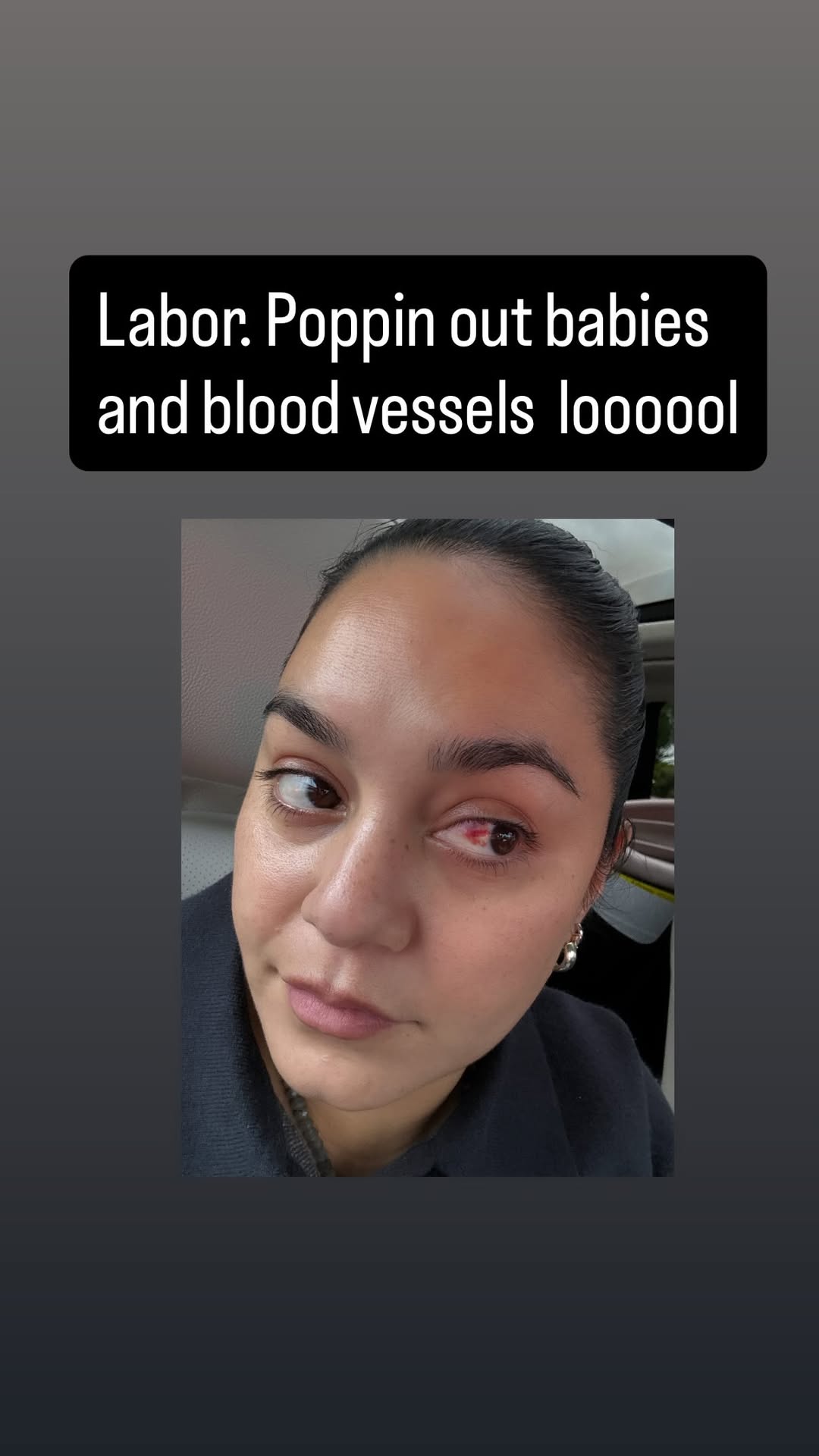 Vanessa Hudgens Welcomes Baby No. 2, Bursts Blood Vessels During Labor